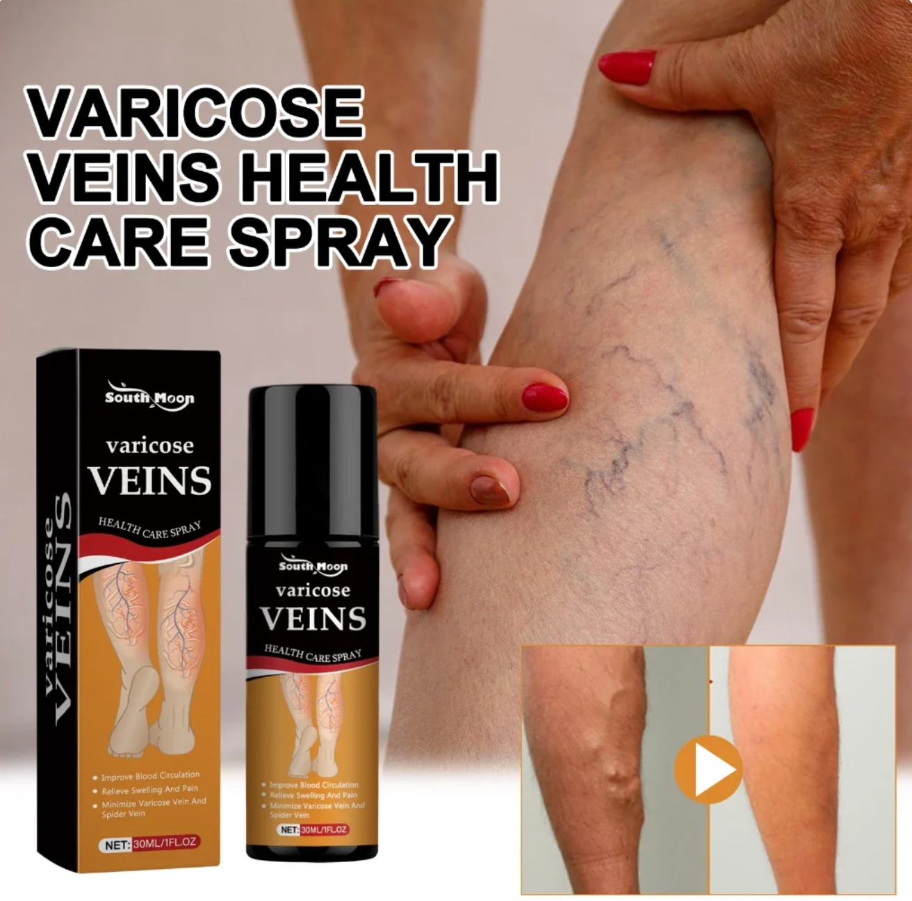 VeinVeda Varicose Vein Relief Spray  (BUY 1 GET 2 FREE)