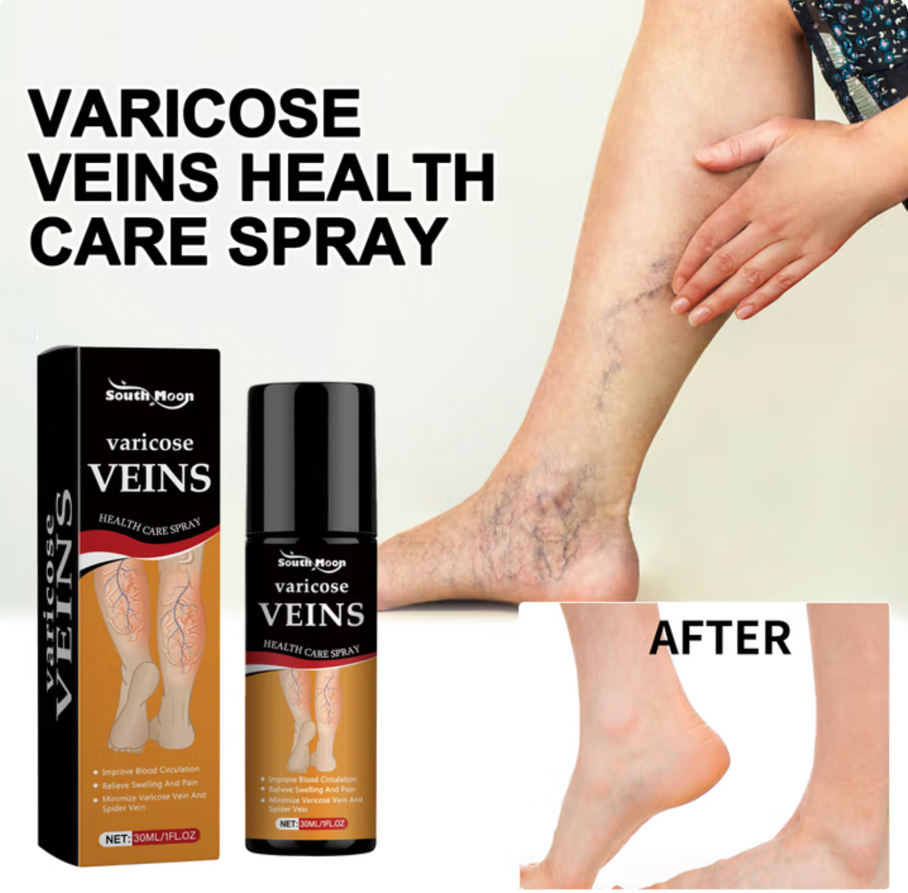 VeinVeda Varicose Vein Relief Spray  (BUY 1 GET 2 FREE)